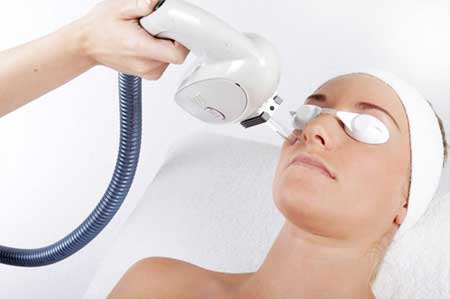 درمان منافذ باز پوست با لیزر